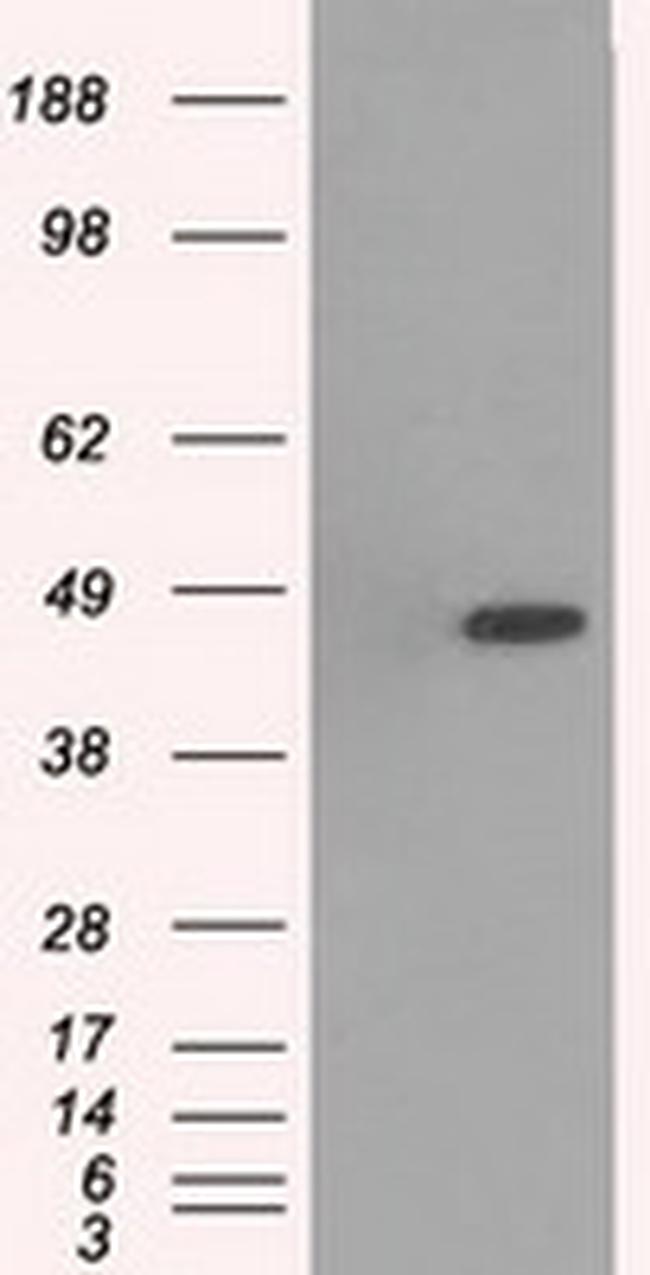 MAPK12 Antibody in Western Blot (WB)