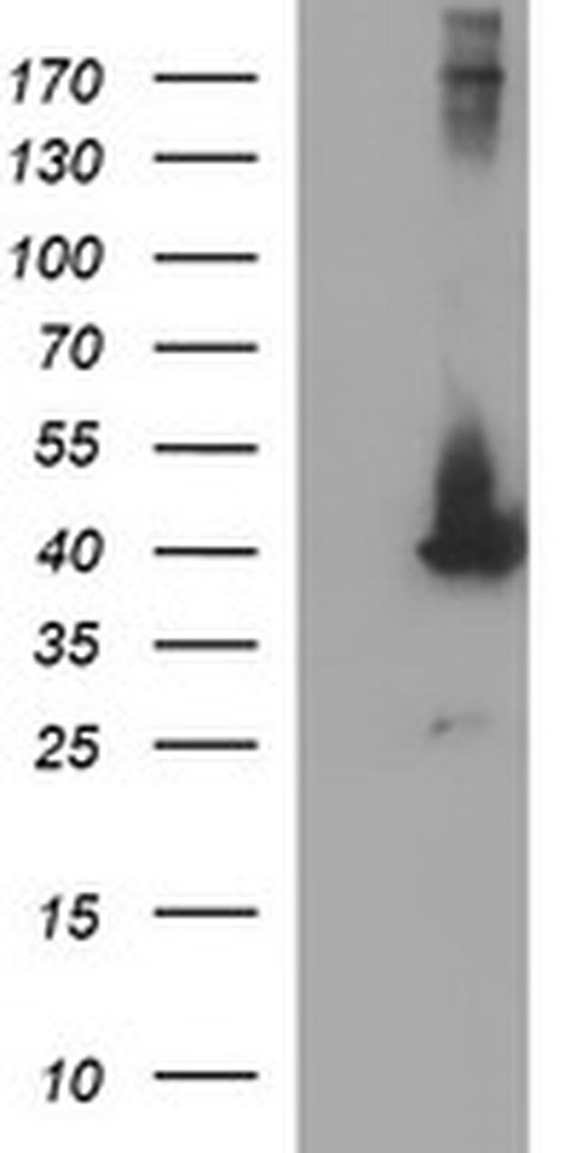 MAPK13 Antibody in Western Blot (WB)