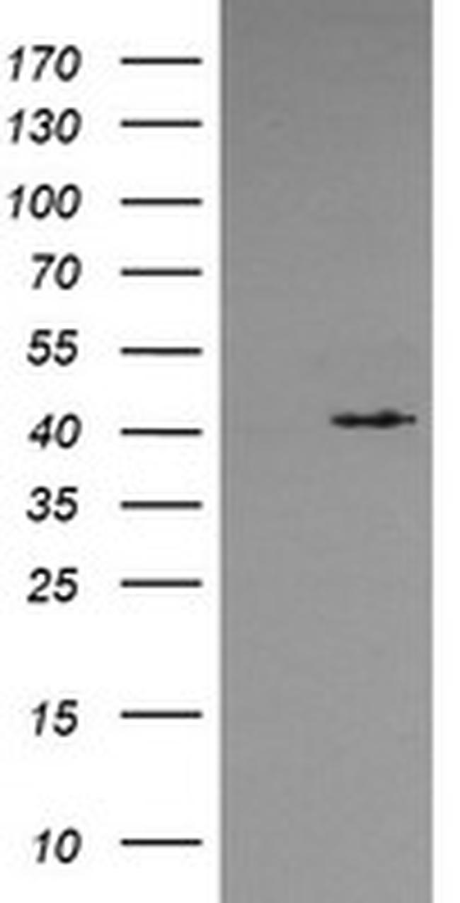 MAPK13 Antibody in Western Blot (WB)