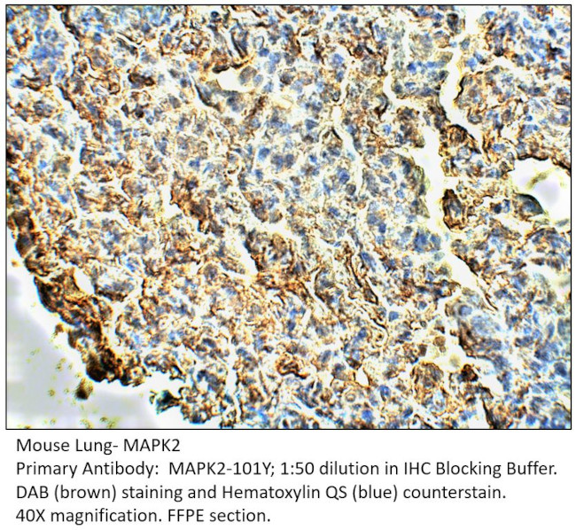 MAPK2 Antibody in Immunohistochemistry (IHC)