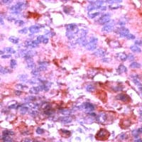 ERK1 Antibody in Immunohistochemistry (IHC)