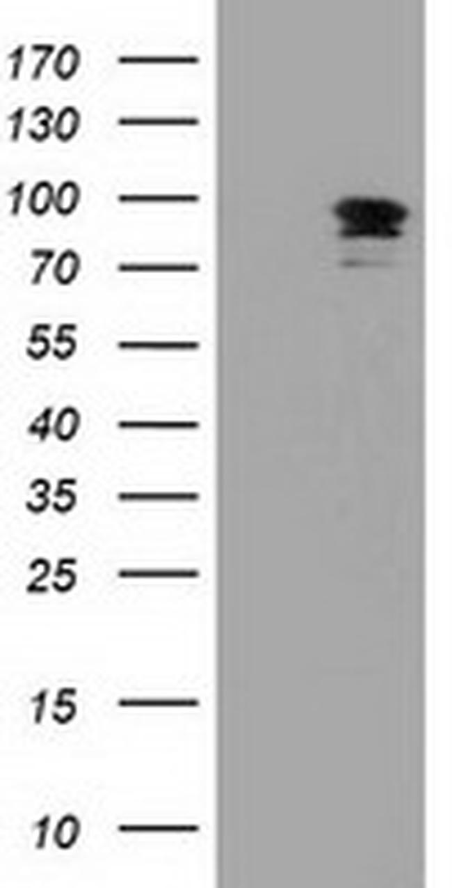 MAPK7 Antibody in Western Blot (WB)