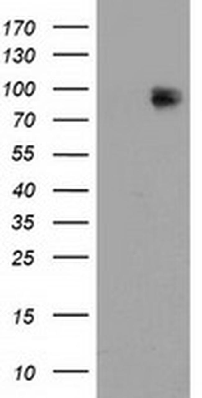 MAPK7 Antibody in Western Blot (WB)