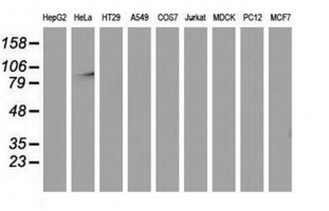 MAPK7 Antibody in Western Blot (WB)