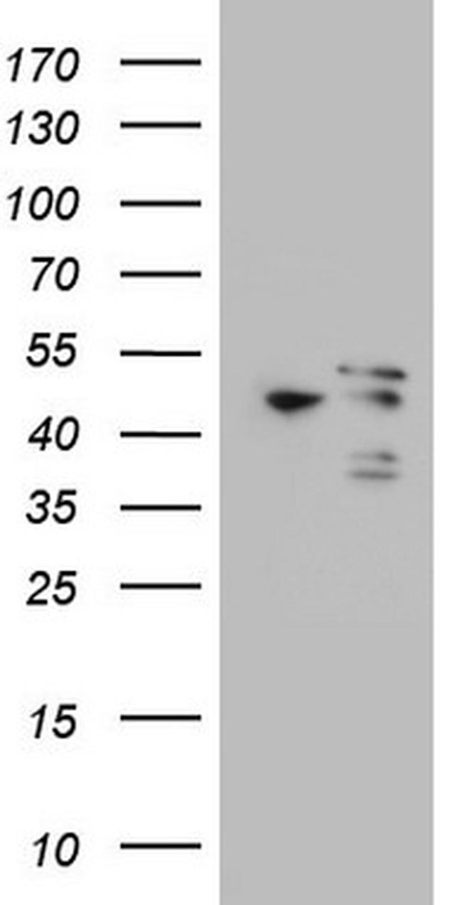 MAPKAPK5 Antibody in Western Blot (WB)