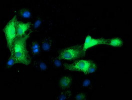 EB2 (MAPRE2) Antibody in Immunocytochemistry (ICC/IF)