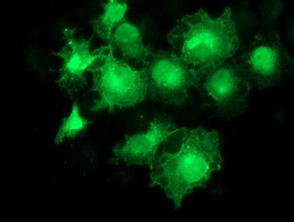 EB2 (MAPRE2) Antibody in Immunocytochemistry (ICC/IF)