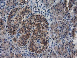 EB2 (MAPRE2) Antibody in Immunohistochemistry (Paraffin) (IHC (P))