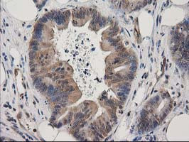 EB2 (MAPRE2) Antibody in Immunohistochemistry (Paraffin) (IHC (P))