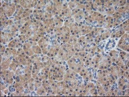 EB2 (MAPRE2) Antibody in Immunohistochemistry (Paraffin) (IHC (P))