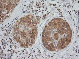 EB2 (MAPRE2) Antibody in Immunohistochemistry (Paraffin) (IHC (P))