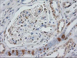 EB2 (MAPRE2) Antibody in Immunohistochemistry (Paraffin) (IHC (P))