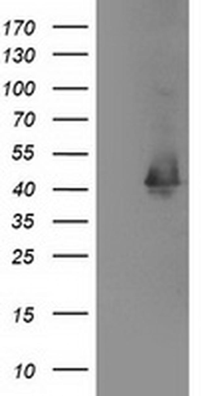 EB2 (MAPRE2) Antibody in Western Blot (WB)