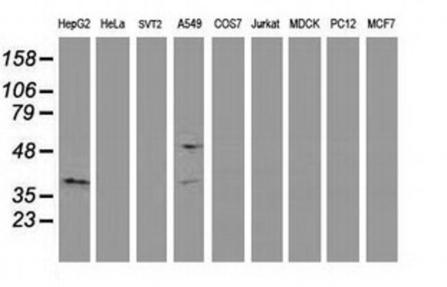 EB2 (MAPRE2) Antibody in Western Blot (WB)