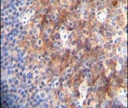 MARCO Antibody in Immunohistochemistry (IHC)