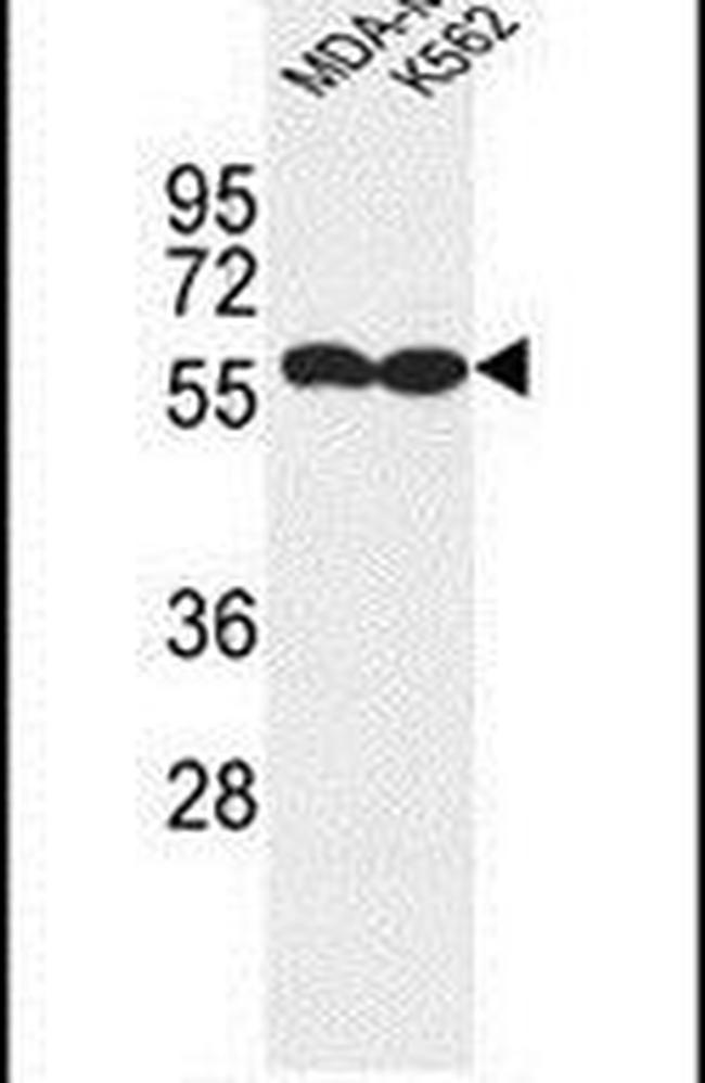 MARCO Antibody in Western Blot (WB)