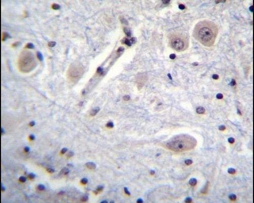 MARK1 Antibody in Immunohistochemistry (IHC)