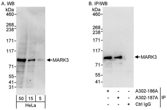 MARK3 Antibody in Western Blot (WB)