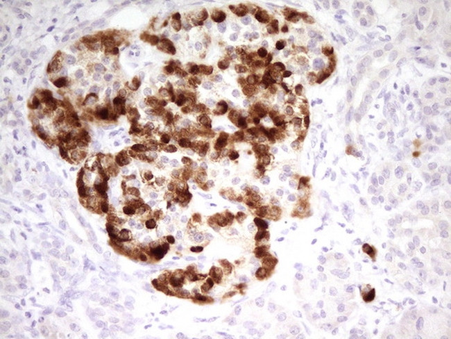 MARK3 Antibody in Immunohistochemistry (Paraffin) (IHC (P))