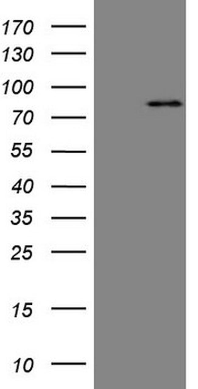 MARK3 Antibody in Western Blot (WB)