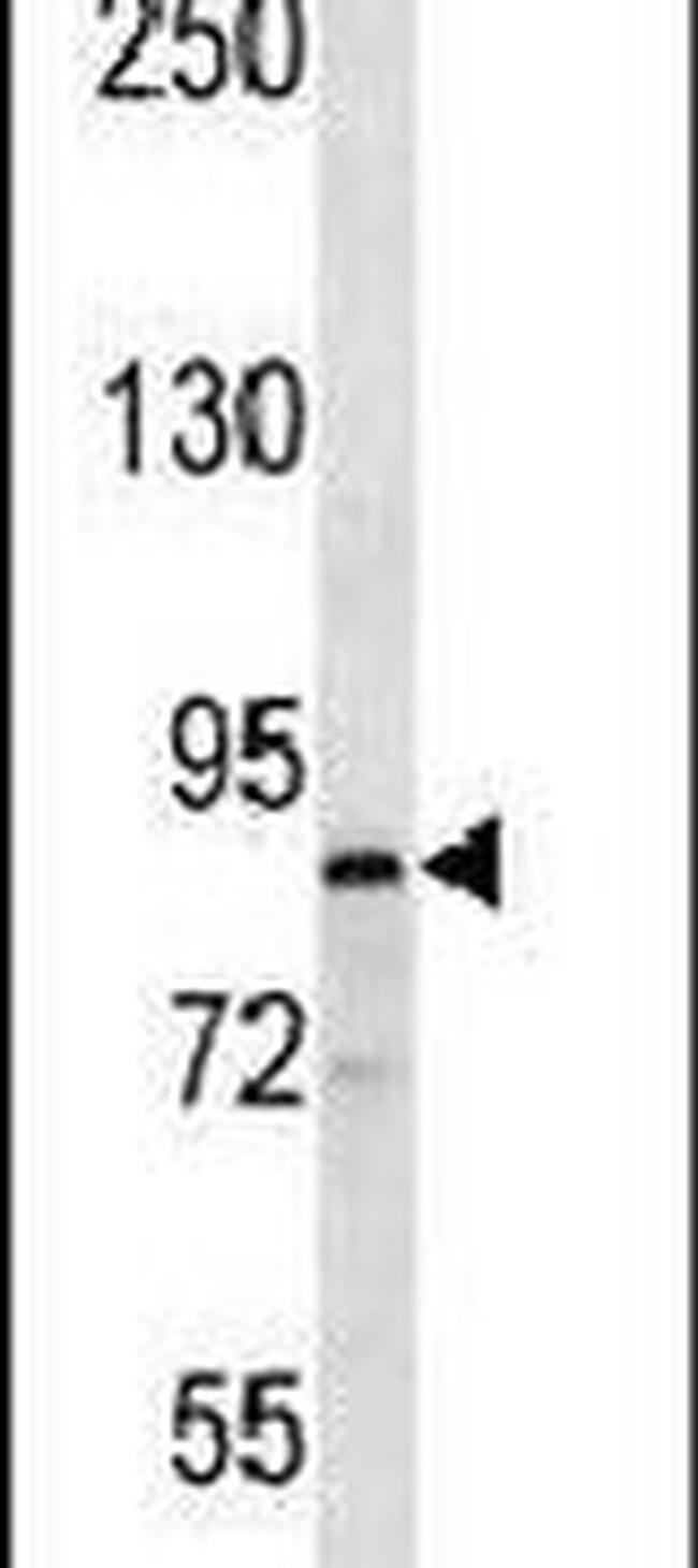 MARK1 Antibody in Western Blot (WB)