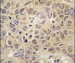 MARS Antibody in Immunohistochemistry (IHC)