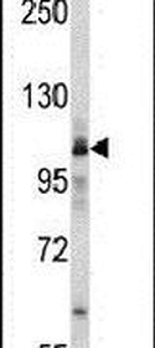 MARS Antibody in Western Blot (WB)