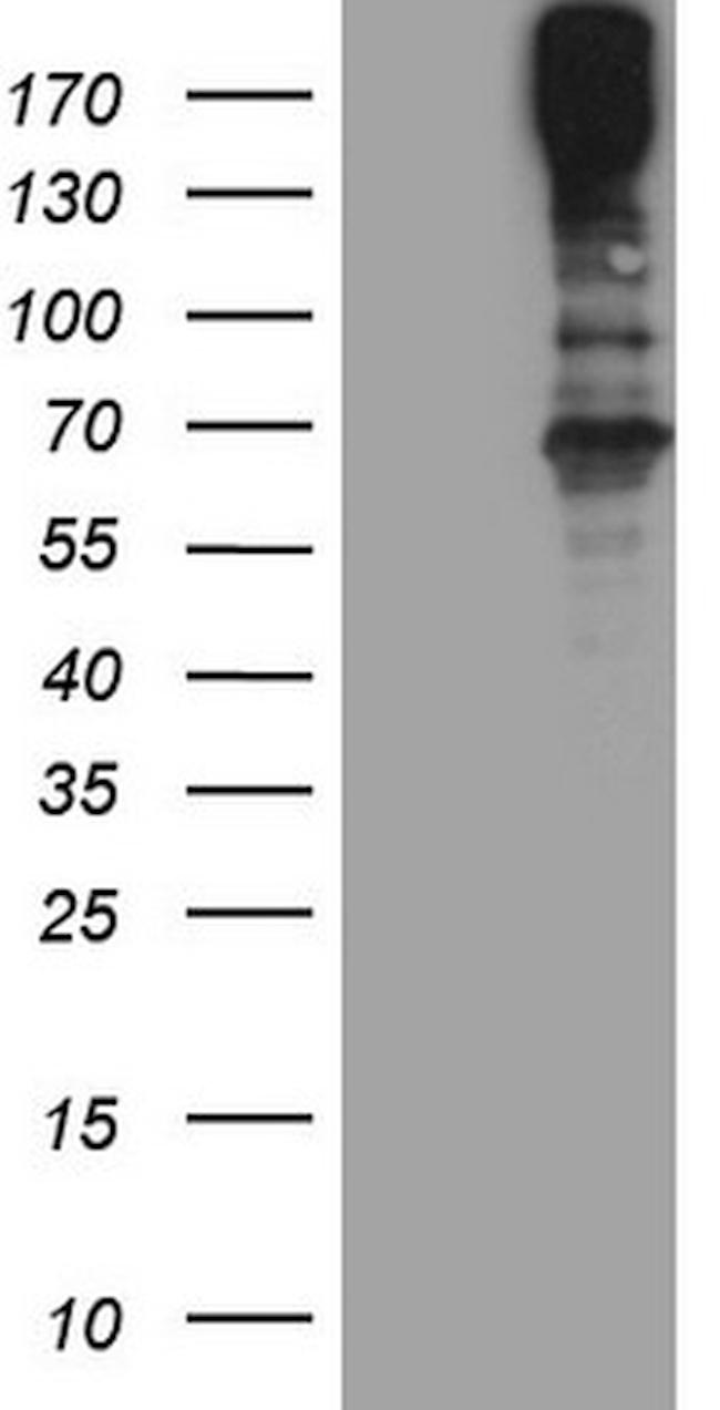 MAST2 Antibody in Western Blot (WB)