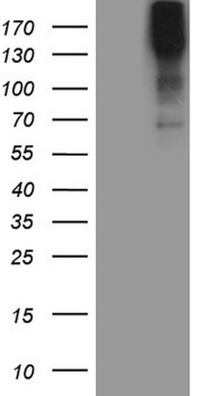 MAST2 Antibody in Western Blot (WB)