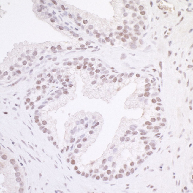 MAZ/SAF-1 Antibody in Immunohistochemistry (IHC)