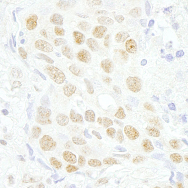 MAZ/SAF-1 Antibody in Immunohistochemistry (IHC)