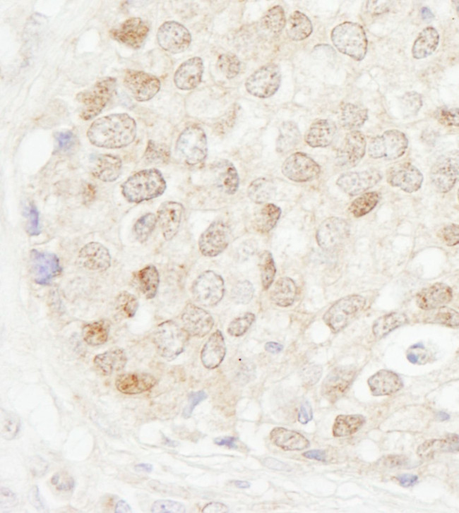 MBD4 Antibody in Immunohistochemistry (IHC)