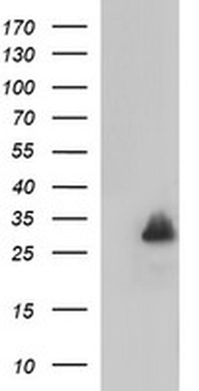 MBL2 Antibody in Western Blot (WB)