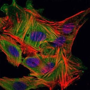 MBP Antibody in Immunocytochemistry (ICC/IF)