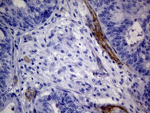 MCAM Antibody in Immunohistochemistry (Paraffin) (IHC (P))