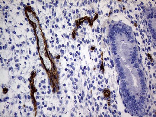 MCAM Antibody in Immunohistochemistry (Paraffin) (IHC (P))