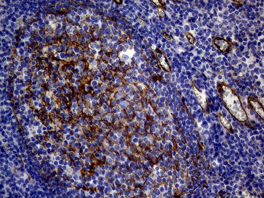 MCAM Antibody in Immunohistochemistry (Paraffin) (IHC (P))