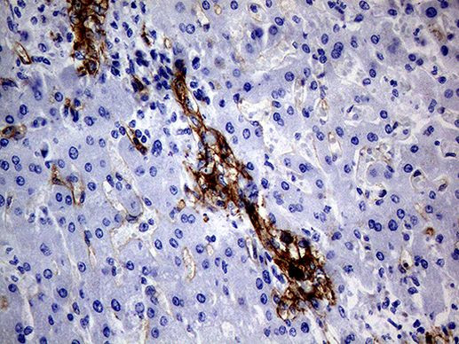 MCAM Antibody in Immunohistochemistry (Paraffin) (IHC (P))