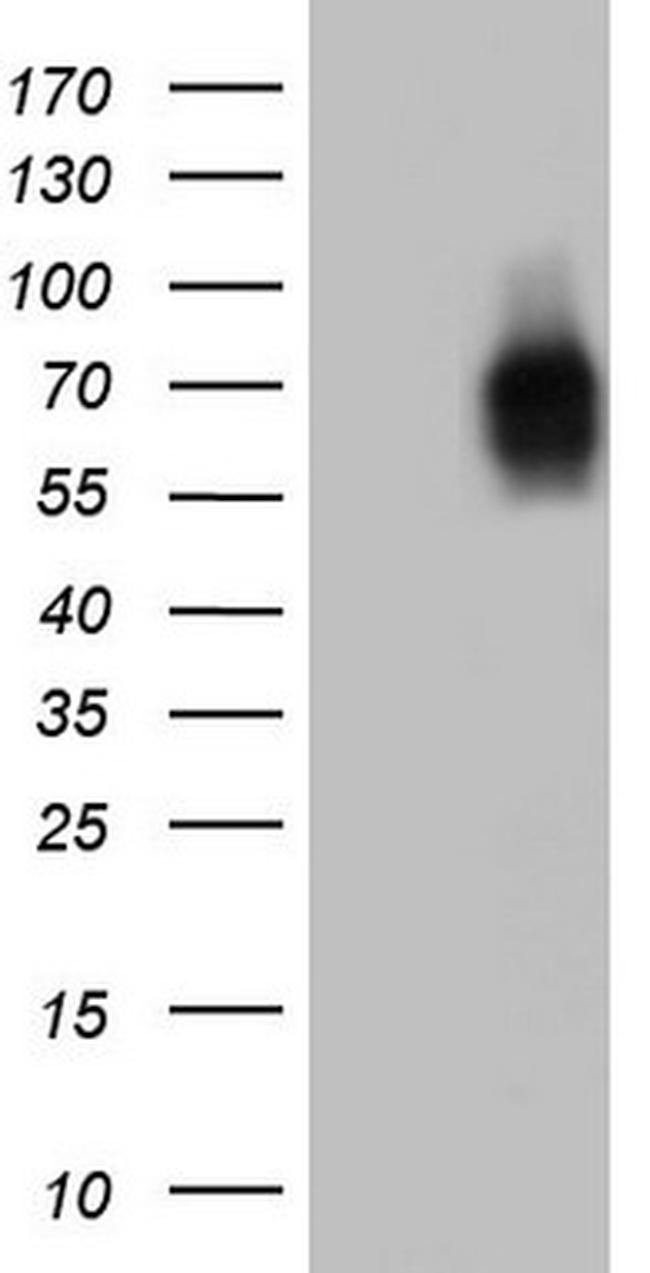 MCAM Antibody in Western Blot (WB)