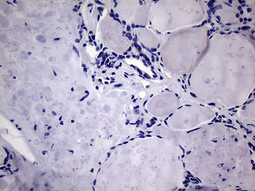 MCEE Antibody in Immunohistochemistry (Paraffin) (IHC (P))