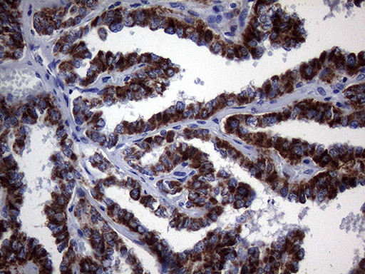 MCEE Antibody in Immunohistochemistry (Paraffin) (IHC (P))