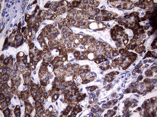 MCEE Antibody in Immunohistochemistry (Paraffin) (IHC (P))