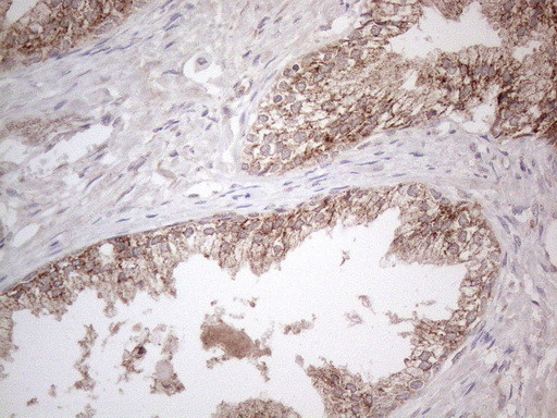 MCEE Antibody in Immunohistochemistry (Paraffin) (IHC (P))