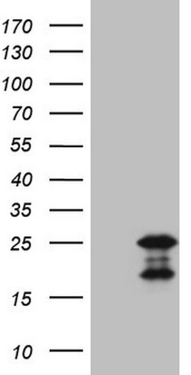 MCEE Antibody in Western Blot (WB)