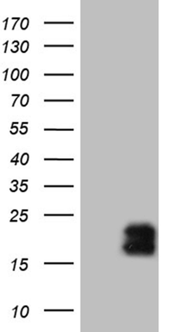 MCEE Antibody in Western Blot (WB)