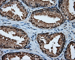 MCL1 Antibody in Immunohistochemistry (Paraffin) (IHC (P))