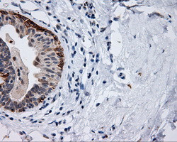 MCL1 Antibody in Immunohistochemistry (Paraffin) (IHC (P))