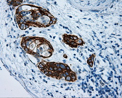 MCL1 Antibody in Immunohistochemistry (Paraffin) (IHC (P))