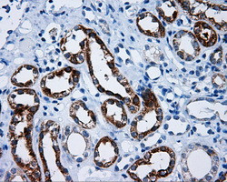 MCL1 Antibody in Immunohistochemistry (Paraffin) (IHC (P))