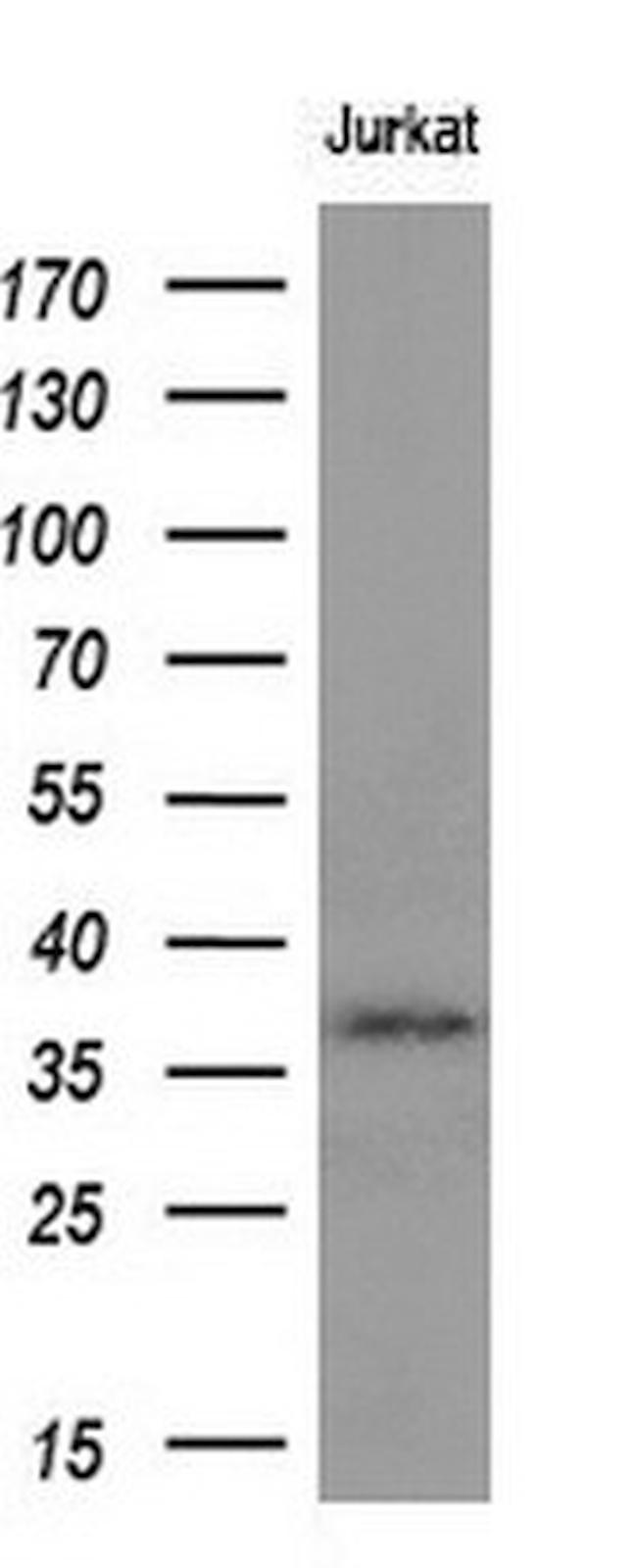 MCL1 Antibody in Western Blot (WB)